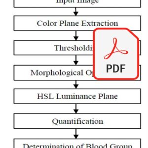 طراحي و پیادهسازی نرمافزاری جهت تعیین نوع گروه خوني با استفاده از تکنیکهای پردازش تصویر